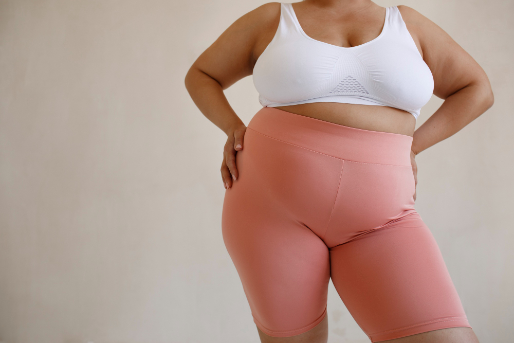 Lipedema: The Misunderstood Condition Affecting Millions