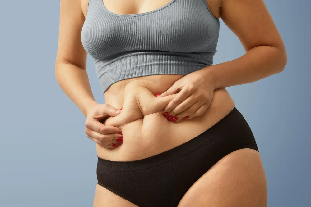 Lipedema vs. Obesity: How to Tell the Difference