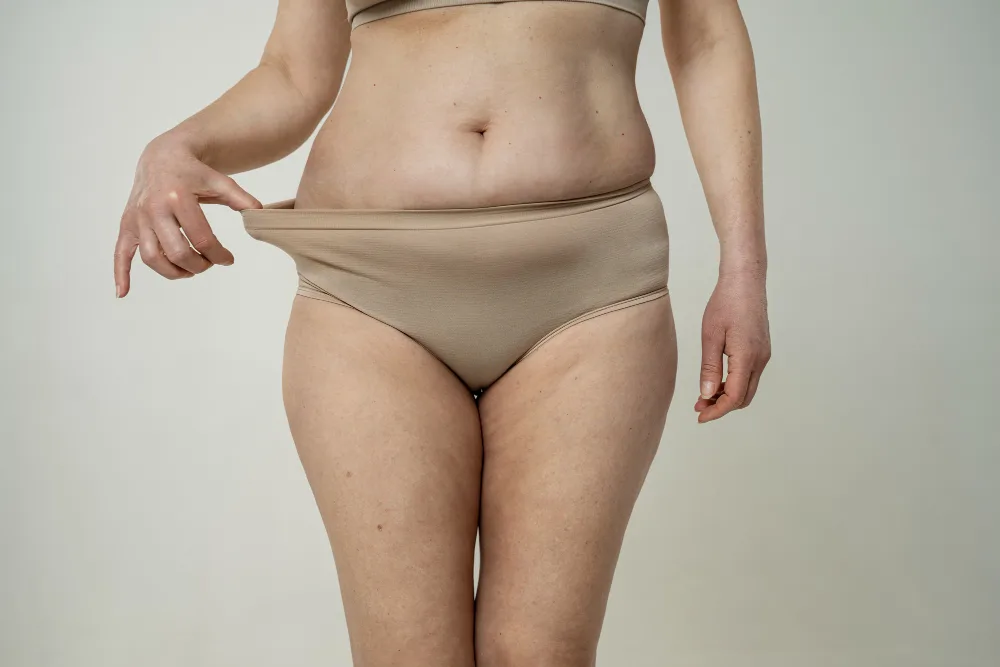 Lipedema Treatment in Florida: Options for Misdiagnosed Patients