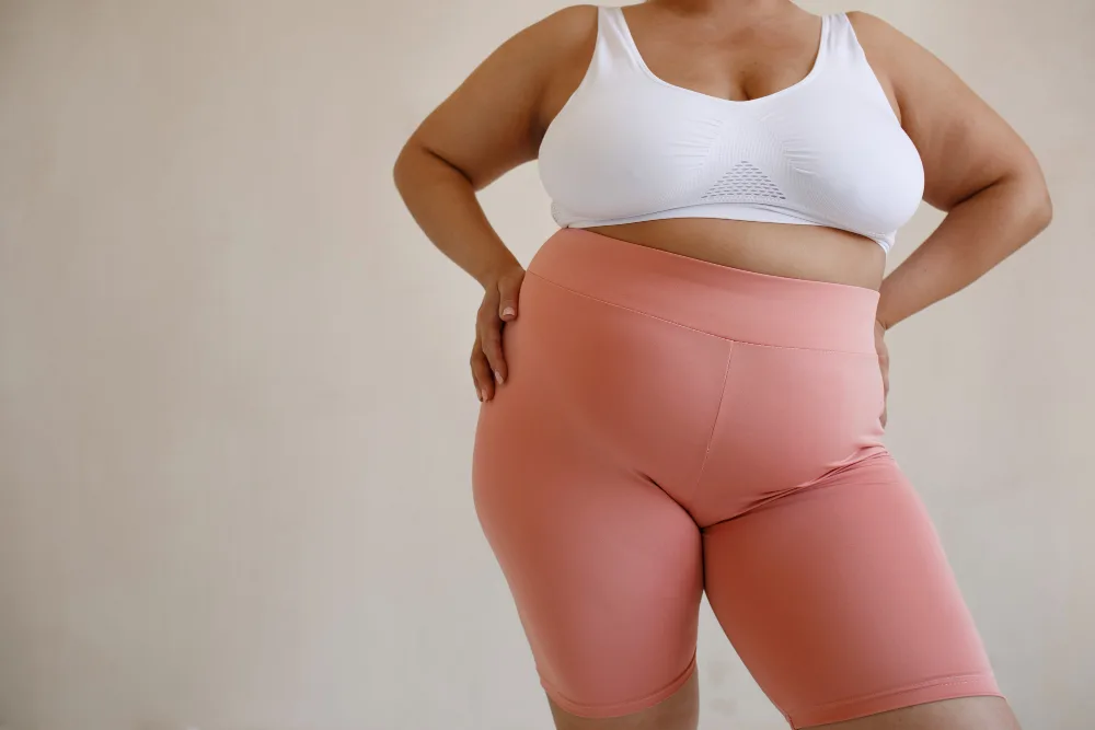 Lipedema: The Misunderstood Condition Affecting Millions