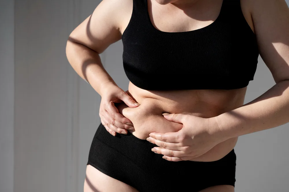 What Studies Tell Us About Lipedema and Its Treatment Options