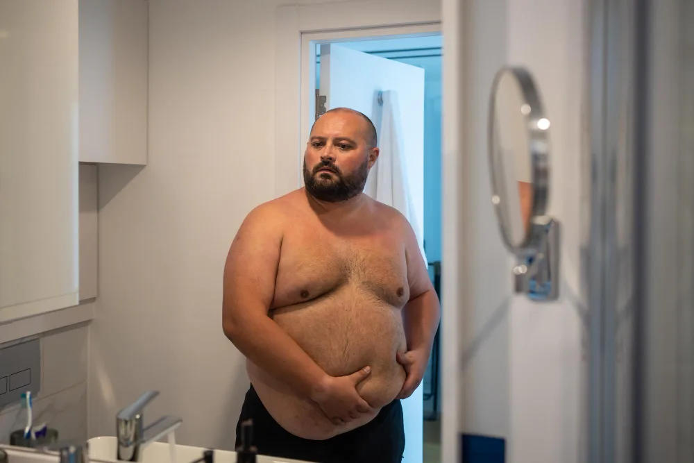 Is It Really Lipedema? Conditions Often Mistaken for This Disorder