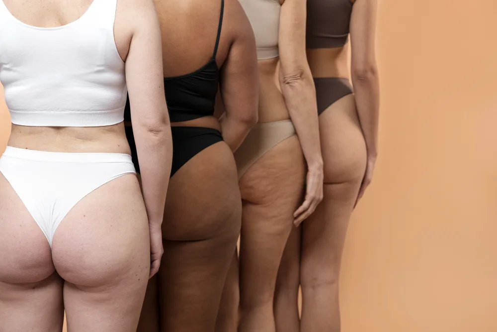 Lipedema Surgery Options: Managing Pain and Swelling in Florida