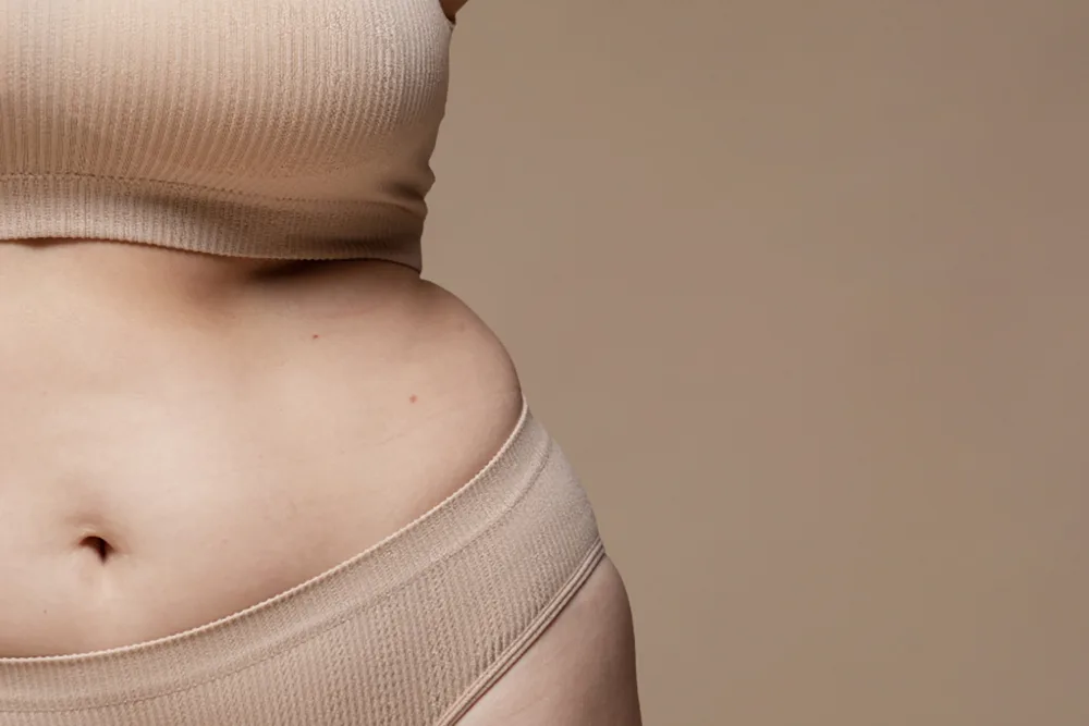 What Is Lipedema Surgery? Pros, Cons, and What to Expect